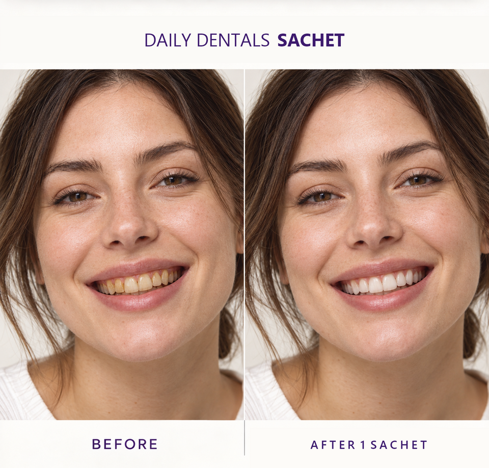 Daily Dentals Purple Whitening Mouthwash — 20 individual sachets